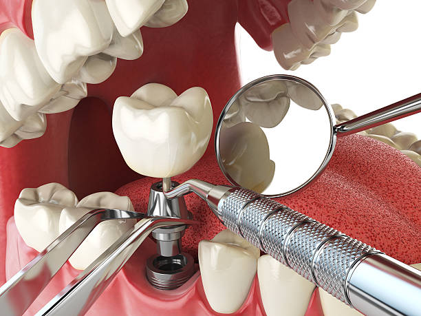 Best Urgent Dental Care for Toothache in Fort Mckinley, OH